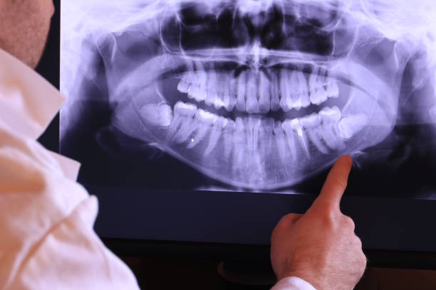 Best Tooth Infection Emergency Dentist  in Gillett, WI